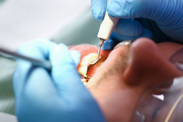 Best Emergency Care for Gum Disease in Amherst, VA