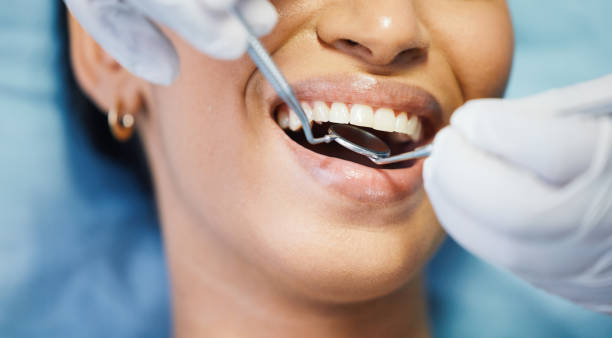Best Emergency Cosmetic Dentistry (e.g., broken veneers) in Amherst, VA